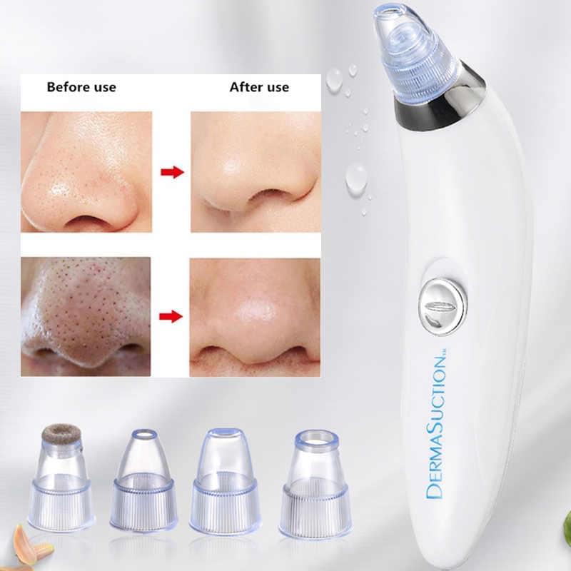 Derma Blackhead Remover Device