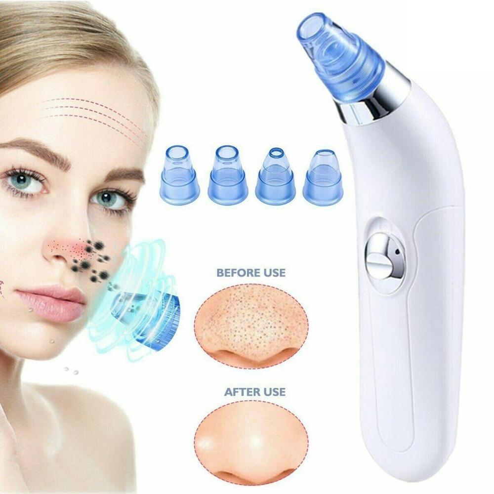 Derma Blackhead Remover Device