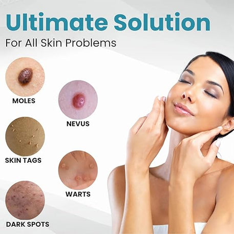 Mole and Wart Removal Pen